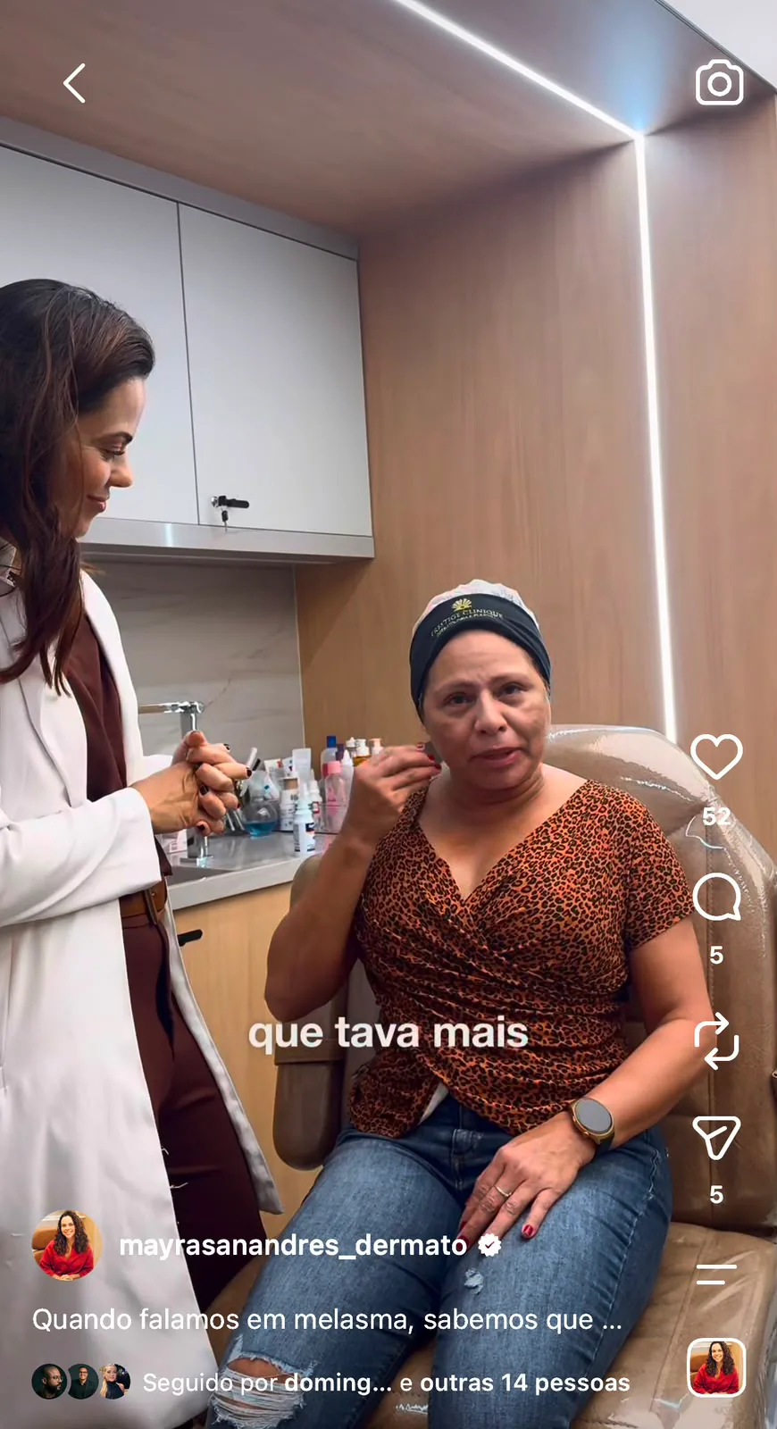 Reel da Dra. Mayra Sanandres sobre tratamento de melasma durante atendimento na Prestige Clinique em Itaboraí